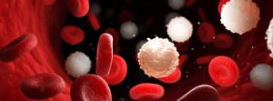 Leucemia aguda sigue en aumento en Colombia.
